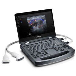 MINDRAY MX3 ULTRASOUND (PORTABLE/COLORED)