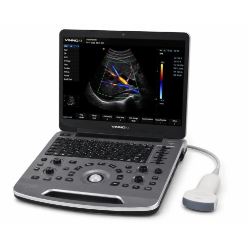 VINNO A3 PORTABLE ULTRASOUND (COLORED) VINNO A3 PORTABLE ULTRASOUND (COLORED)
